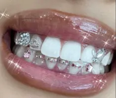 teeth-jewelry-edmonton